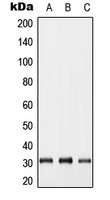 GJB5 / CX30.1 / Connexin 31.1 Antibody - Western blot analysis of Connexin 31.1 expression in A549 (A); Raw264.7 (B); H9C2 (C) whole cell lysates.
