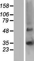GJB5 / CX30.1 / Connexin 31.1 Protein - Western validation with an anti-DDK antibody * L: Control HEK293 lysate R: Over-expression lysate