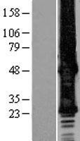 GJB6 / CX30 / Connexin 30 Protein - Western validation with an anti-DDK antibody * L: Control HEK293 lysate R: Over-expression lysate