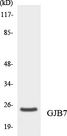 GJB7 / CX25 / Connexin 25 Antibody - Western blot analysis of the lysates from HeLa cells using GJB7 antibody.