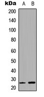 GJB7 / CX25 / Connexin 25 Antibody - Western blot analysis of Connexin 25 expression in HEK293T (A); SHSY5Y (B) whole cell lysates.