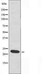 GJB7 / CX25 / Connexin 25 Antibody - Western blot analysis of extracts of HT29 cells using GJB7 antibody.