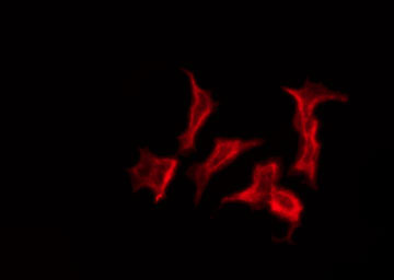 GJB7 / CX25 / Connexin 25 Antibody - Staining HT29 cells by IF/ICC. The samples were fixed with PFA and permeabilized in 0.1% Triton X-100, then blocked in 10% serum for 45 min at 25°C. The primary antibody was diluted at 1:200 and incubated with the sample for 1 hour at 37°C. An Alexa Fluor 594 conjugated goat anti-rabbit IgG (H+L) Ab, diluted at 1/600, was used as the secondary antibody.