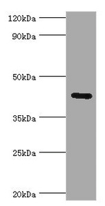 GJC1 / CX45 / Connexin 45 Antibody - Western blot All lanes: Gap junction gamma-1 protein antibody at 6µg/ml + 293T whole cell lysate Secondary Goat polyclonal to rabbit IgG at 1/10000 dilution Predicted band size: 45 kDa Observed band size: 45 kDa