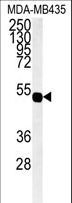 GJC1 / CX45 / Connexin 45 Antibody - Western blot of hGJA7-H104.Connexin in MDA-MB435 cell line lysates (35 ug/lane). GJA7 (arrow) was detected using the purified antibody.