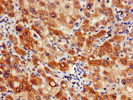 GJC1 / CX45 / Connexin 45 Antibody - Immunohistochemistry of paraffin-embedded human liver tissue at dilution of 1:100