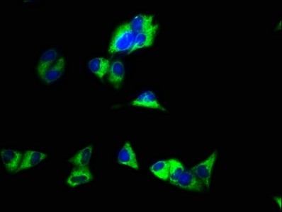 GJC1 / CX45 / Connexin 45 Antibody - Immunofluorescence staining of Hela cells with GJC1 Antibody at 1:100, counter-stained with DAPI. The cells were fixed in 4% formaldehyde, permeabilized using 0.2% Triton X-100 and blocked in 10% normal Goat Serum. The cells were then incubated with the antibody overnight at 4°C. The secondary antibody was Alexa Fluor 488-congugated AffiniPure Goat Anti-Rabbit IgG(H+L).