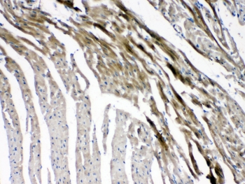 GJC1 / CX45 / Connexin 45 Antibody - IHC testing of FFPE mouse heart tissue with GJC1 antibody at 1ug/ml. Required HIER: steam section in pH6 citrate buffer for 20 min and allow to cool prior to testing.