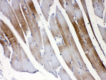 GJC1 / CX45 / Connexin 45 Antibody - IHC testing of FFPE rat skeletal muscle tissue with GJC1 antibody at 1ug/ml. Required HIER: steam section in pH6 citrate buffer for 20 min and allow to cool prior to testing.