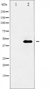 GJC1 / CX45 / Connexin 45 Antibody - Western blot analysis of Connexin 45 expression in rat heart. The lane on the left is treated with the antigen-specific peptide.