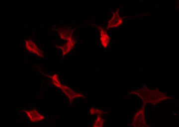 GJC1 / CX45 / Connexin 45 Antibody - Staining HeLa cells by IF/ICC. The samples were fixed with PFA and permeabilized in 0.1% Triton X-100, then blocked in 10% serum for 45 min at 25°C. The primary antibody was diluted at 1:200 and incubated with the sample for 1 hour at 37°C. An Alexa Fluor 594 conjugated goat anti-rabbit IgG (H+L) Ab, diluted at 1/600, was used as the secondary antibody.