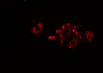 GJC1 / CX45 / Connexin 45 Antibody - Staining HeLa cells by IF/ICC. The samples were fixed with PFA and permeabilized in 0.1% Triton X-100, then blocked in 10% serum for 45 min at 25°C. The primary antibody was diluted at 1:200 and incubated with the sample for 1 hour at 37°C. An Alexa Fluor 594 conjugated goat anti-rabbit IgG (H+L) antibody, diluted at 1/600, was used as secondary antibody.