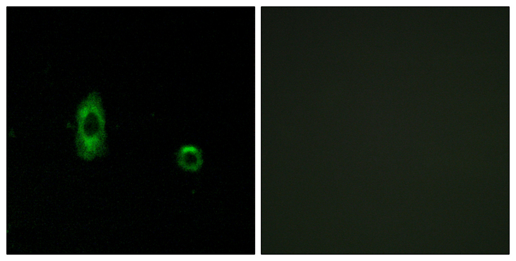 GJC2 Antibody - Immunofluorescence analysis of A549 cells, using CXG2 Antibody. The picture on the right is blocked with the synthesized peptide.