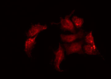 GJC2 Antibody - Staining A549 cells by IF/ICC. The samples were fixed with PFA and permeabilized in 0.1% Triton X-100, then blocked in 10% serum for 45 min at 25°C. The primary antibody was diluted at 1:200 and incubated with the sample for 1 hour at 37°C. An Alexa Fluor 594 conjugated goat anti-rabbit IgG (H+L) Ab, diluted at 1/600, was used as the secondary antibody.