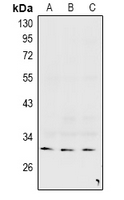 GJC3 / GJE1 Antibody - Western blot analysis of Connexin 31.3 expression in mouse brain (A), rat brain (B), HepG2 (C) whole cell lysates.