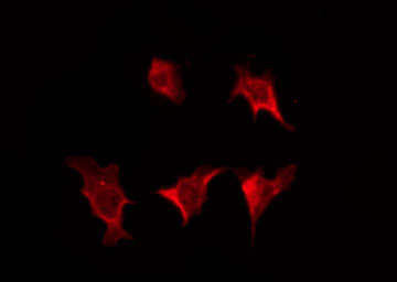 GJC3 / GJE1 Antibody - Staining LOVO cells by IF/ICC. The samples were fixed with PFA and permeabilized in 0.1% Triton X-100, then blocked in 10% serum for 45 min at 25°C. The primary antibody was diluted at 1:200 and incubated with the sample for 1 hour at 37°C. An Alexa Fluor 594 conjugated goat anti-rabbit IgG (H+L) Ab, diluted at 1/600, was used as the secondary antibody.