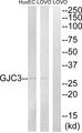 GJC3 / GJE1 Antibody - Western blot analysis of extracts from LOVO and HuvEc cells, using GJC3 antibody.