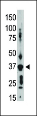 GJD2 / CX36 / Connexin 36 Antibody - The anti-GJA9 C-term antibody is used in Western blot to detect GJA9 in placenta tissue lysate.