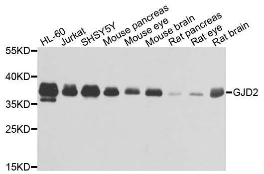 GJD2 / CX36 / Connexin 36 Antibody - Western blot analysis of extracts of various cells.