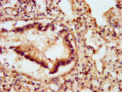 GJD2 / CX36 / Connexin 36 Antibody - Immunohistochemistry image at a dilution of 1:500 and staining in paraffin-embedded human lung tissue performed on a Leica BondTM system. After dewaxing and hydration, antigen retrieval was mediated by high pressure in a citrate buffer (pH 6.0) . Section was blocked with 10% normal goat serum 30min at RT. Then primary antibody (1% BSA) was incubated at 4 °C overnight. The primary is detected by a biotinylated secondary antibody and visualized using an HRP conjugated SP system.