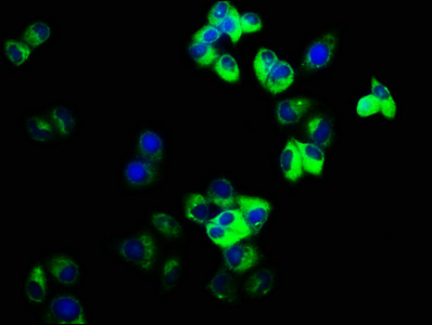 GJD2 / CX36 / Connexin 36 Antibody - Immunofluorescence staining of Hela cells with GJD2 Antibody at 1:166, counter-stained with DAPI. The cells were fixed in 4% formaldehyde, permeabilized using 0.2% Triton X-100 and blocked in 10% normal Goat Serum. The cells were then incubated with the antibody overnight at 4°C. The secondary antibody was Alexa Fluor 488-congugated AffiniPure Goat Anti-Rabbit IgG(H+L).