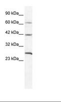 GJD3 / CX31.9 / Connexin 3.9 Antibody - HepG2 Cell Lysate.  This image was taken for the unconjugated form of this product. Other forms have not been tested.