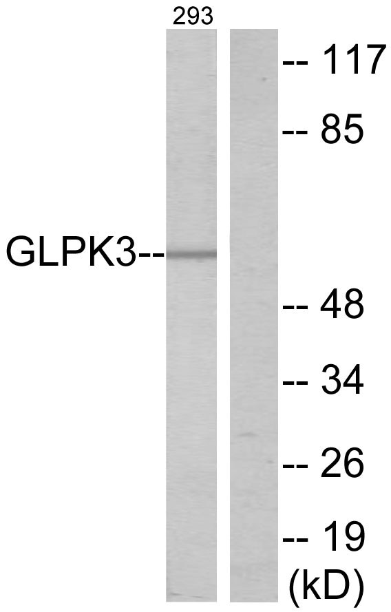 GK / Glycerol Kinase Antibody - Western blot analysis of lysates from 293 cells, using GK3 Antibody. The lane on the right is blocked with the synthesized peptide.