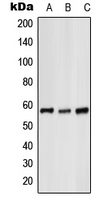 GK / Glycerol Kinase Antibody - Western blot analysis of Glycerol Kinase 1 expression in HeLa (A); mouse liver (B); H9C2 (C) whole cell lysates.