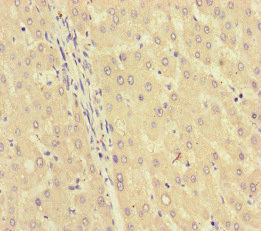 GK / Glycerol Kinase Antibody - Immunohistochemistry of paraffin-embedded human liver tissue at dilution of 1:100
