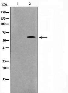 GK / Glycerol Kinase Antibody - Western blot analysis on 293 cell lysates using GK antibody. The lane on the left is treated with the antigen-specific peptide.