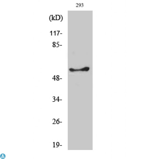 GK / Glycerol Kinase Antibody - Western Blot (WB) analysis of specific cells using GK1/3 polyclonal antibody.