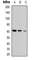 GK / Glycerol Kinase Antibody - Western blot analysis of Glycerol Kinase 1 expression in Jurkat (A); HepG2 (B); HEK293T (C) whole cell lysates.