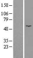 GK / Glycerol Kinase Protein - Western validation with an anti-DDK antibody * L: Control HEK293 lysate R: Over-expression lysate