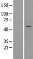 GK / Glycerol Kinase Protein - Western validation with an anti-DDK antibody * L: Control HEK293 lysate R: Over-expression lysate