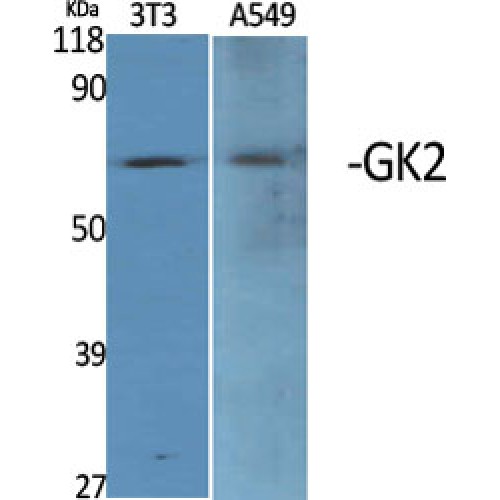 GK2 / Glycerol Kinase 2 Antibody - Western blot of GK2 antibody