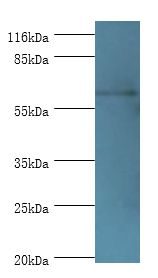 GK2 / Glycerol Kinase 2 Antibody - Western blot. All lanes: Glycerol kinase 2 antibody at 2 ug/ml+Jurkat whole cell lysate. Secondary antibody: goat polyclonal to rabbit at 1:10000 dilution. Predicted band size: 61 kDa. Observed band size: 61 kDa.  This image was taken for the unconjugated form of this product. Other forms have not been tested.