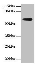 GK2 / Glycerol Kinase 2 Antibody - Western blot All lanes: Glycerol kinase 2 antibody at 2µg/ml + jurkat whole cell lysate Secondary Goat polyclonal to rabbit IgG at 1/10000 dilution Predicted band size: 61 kDa Observed band size: 61 kDa