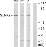 GK2 / Glycerol Kinase 2 Antibody - Western blot analysis of lysates from HeLa, 293, and Jurkat cells, using GK2 Antibody. The lane on the right is blocked with the synthesized peptide.