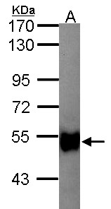 GK2 / Glycerol Kinase 2 Antibody - Sample (30 ug of whole cell lysate). A: Hep G2 . 7.5% SDS PAGE. glycerol kinase 2 antibody. GK2 / Glycerol Kinase 2 antibody diluted at 1:1000.