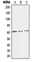 GK2 / Glycerol Kinase 2 Antibody - Western blot analysis of Glycerol Kinase 2 expression in HepG2 (A); HeLa (B); Jurkat (C) whole cell lysates.