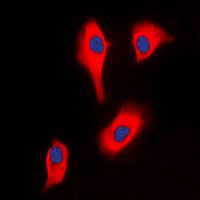 GK2 / Glycerol Kinase 2 Antibody - Immunofluorescent analysis of Glycerol Kinase 2 staining in HeLa cells. Formalin-fixed cells were permeabilized with 0.1% Triton X-100 in TBS for 5-10 minutes and blocked with 3% BSA-PBS for 30 minutes at room temperature. Cells were probed with the primary antibody in 3% BSA-PBS and incubated overnight at 4 C in a humidified chamber. Cells were washed with PBST and incubated with a DyLight 594-conjugated secondary antibody (red) in PBS at room temperature in the dark. DAPI was used to stain the cell nuclei (blue).