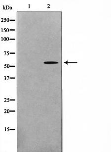 GK2 / Glycerol Kinase 2 Antibody - Western blot analysis on HeLa cell lysates using GK2 antibody. The lane on the left is treated with the antigen-specific peptide.