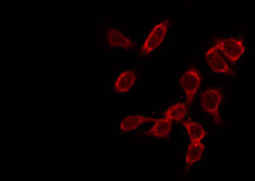 GK2 / Glycerol Kinase 2 Antibody - Staining HeLa cells by IF/ICC. The samples were fixed with PFA and permeabilized in 0.1% Triton X-100, then blocked in 10% serum for 45 min at 25°C. The primary antibody was diluted at 1:200 and incubated with the sample for 1 hour at 37°C. An Alexa Fluor 594 conjugated goat anti-rabbit IgG (H+L) Ab, diluted at 1/600, was used as the secondary antibody.