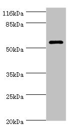 GK3 / Glycerol Kinase 3 Antibody - Western blot All Lanes:GK3P antibody at 2ug/ml+Hela whole cell lysate Secondary Goat polyclonal to rabbit at 1/10000 dilution Predicted band size: 61kDa Observed band size: 61kDa