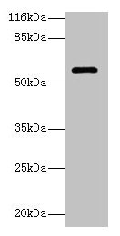 GK3 / Glycerol Kinase 3 Antibody - Western blot All lanes: GK3P antibody at 2µg/ml + Hela whole cell lysate Secondary Goat polyclonal to rabbit IgG at 1/10000 dilution Predicted band size: 61 kDa Observed band size: 61 kDa
