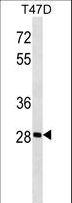 GK5 Antibody - GK5 Antibody western blot of T47D cell line lysates (35 ug/lane). The GK5 antibody detected the GK5 protein (arrow).