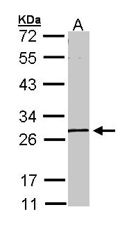 GK5 Antibody - Sample (30 ug of whole cell lysate). A: A431 . 10% SDS PAGE. GK5 antibody diluted at 1:1000