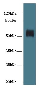 GK5 Antibody - Western blot. All lanes: GK5 antibody at 4 ug/ml+ K562 whole cell lysate Goat polyclonal to rabbit at 1:10000 dilution. Predicted band size: 59 kDa. Observed band size: 59 kDa.