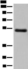 GK5 Antibody - Western blot analysis of Human breast cancer tissue lysate  using GK5 Polyclonal Antibody at dilution of 1:500
