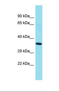 GKAP1 Antibody - Western blot of Human Fetal Kidney. GKAP1 antibody dilution 1.0 ug/ml.  This image was taken for the unconjugated form of this product. Other forms have not been tested.